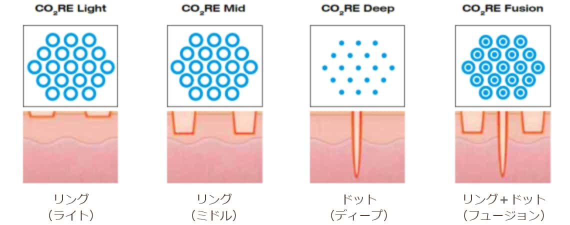 CO2RE Light リング（ライト） CO2RE Mid リング（ミドル） CO2RE Deep ドット（ディープ） CO2RE Fusion リング+ドット（フュージョン）
