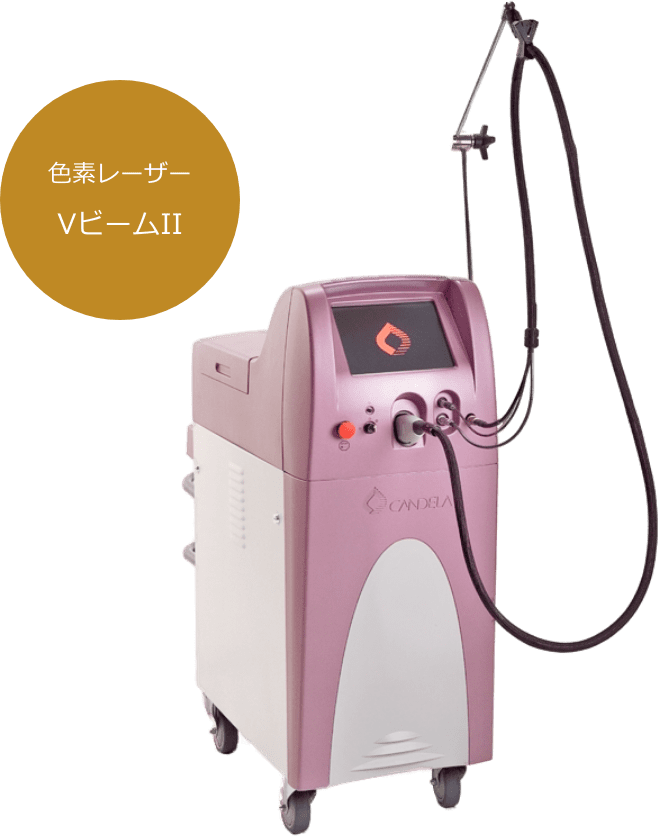 色素レーザー VビームII